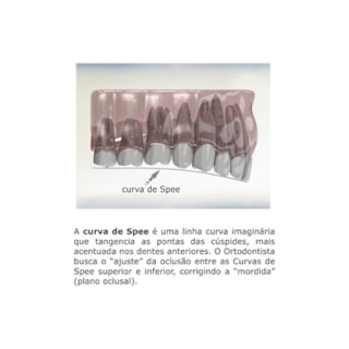 Arco NiTi Superelástico Curva Reversa SPEE Redondo - Morelli