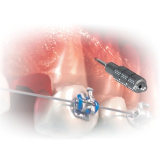 Chave Hexagonal Digital - MORELLI