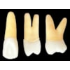 Kit de Dentes para Endo (Dente: 21, 24 e 26) Polpados Radiopacos - Orais