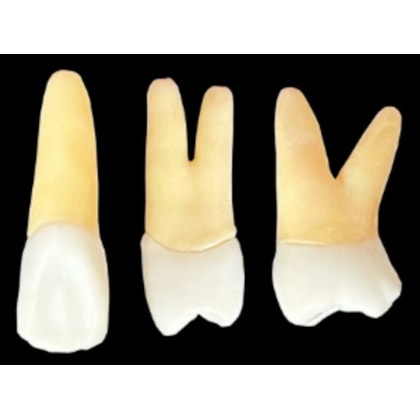Kit de Dentes para Endo (Dente: 21, 24 e 26) Polpados Radiopacos - Orais