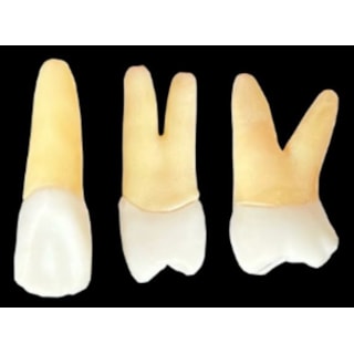 Kit de Dentes para Endo (Dente: 21, 24 e 26) Polpados Radiopacos - Orais Kit de Dentes para Endo (Dente: 21, 24 e 26) Polpados Radiopacos - Orais