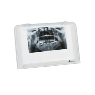 Negatoscópio Luna Slim - Cristofóli Negatoscópio Luna Slim - Cristofóli