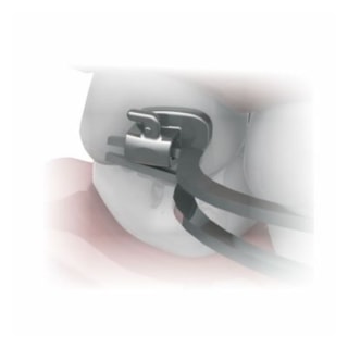 Pinça Ortodôntica para Tubos - MORELLI