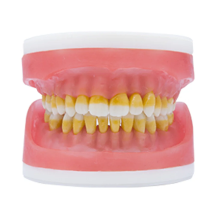 Refil Manequim Para Cirurgia C/ Dentes de Perio AC025.2 - Pronew Refil Manequim Para Cirurgia C/ Dentes de Perio AC025.2 - Pronew