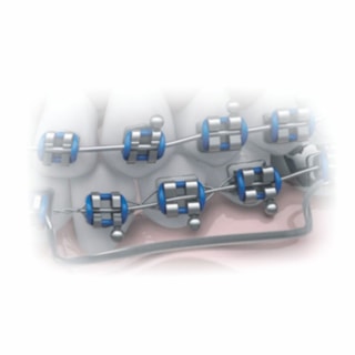 Tubo de Proteção Plástico - MORELLI